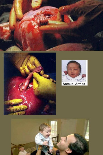 震撼到每一个人！伸出子宫的小手！－佛教