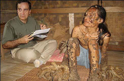 因果感应:一半是人,一半是树